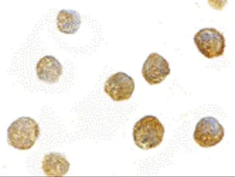 Anti-FYB antibody used in Immunocytochemistry/ Immunofluorescence (ICC/IF). GTX31762