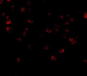 Anti-FYB antibody used in Immunocytochemistry/ Immunofluorescence (ICC/IF). GTX31762
