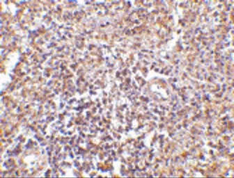 Anti-RAP80 antibody used in IHC (Paraffin sections) (IHC-P). GTX31763