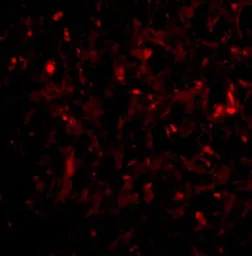 Anti-RAP80 antibody used in IHC (Paraffin sections) (IHC-P). GTX31763