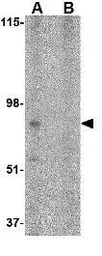 Anti-BRCC45 antibody used in Western Blot (WB). GTX31764