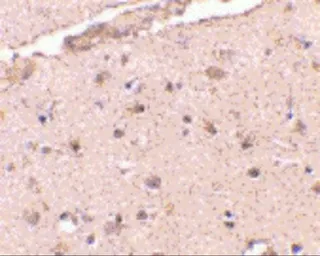 Anti-BRCC36 antibody used in IHC (Paraffin sections) (IHC-P). GTX31765