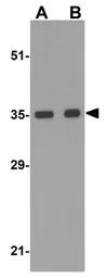 Anti-BRCC36 antibody used in Western Blot (WB). GTX31765