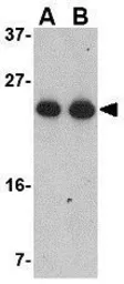 Anti-GSTP1 antibody used in Western Blot (WB). GTX31766