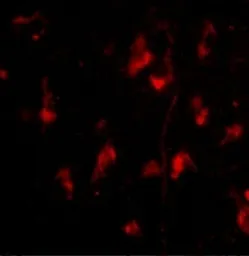 Anti-ATG12 antibody used in IHC (Paraffin sections) (IHC-P). GTX31768