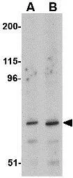 Anti-ASAH2 antibody used in Western Blot (WB). GTX31775