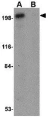 Anti-Integrin alpha 4 antibody used in Western Blot (WB). GTX31777