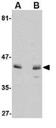 Anti-Activin Receptor Type IA antibody used in Western Blot (WB). GTX31779