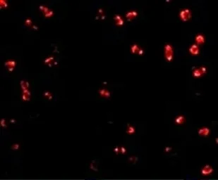 Anti-Integrin alpha 4 antibody used in Immunocytochemistry/ Immunofluorescence (ICC/IF). GTX31781