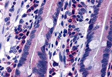 Anti-DISP2 antibody used in IHC (Paraffin sections) (IHC-P). GTX31782