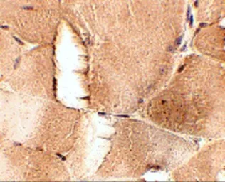 Anti-JPH1 antibody used in IHC (Paraffin sections) (IHC-P). GTX31783