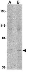 Anti-JPH1 antibody used in Western Blot (WB). GTX31783