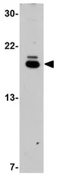 Anti-STK39 antibody used in Western Blot (WB). GTX31784