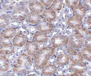 Anti-MTCH2 antibody used in IHC (Paraffin sections) (IHC-P). GTX31786