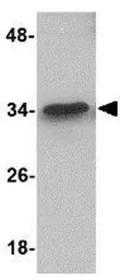 Anti-MTCH2 antibody used in Western Blot (WB). GTX31786
