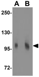 Anti-Matrilin 2 antibody used in Western Blot (WB). GTX31788