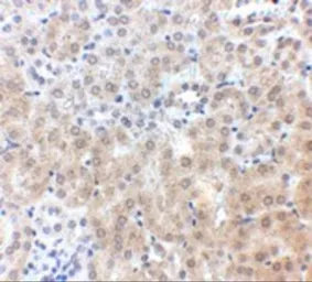 Anti-NPC1 antibody used in IHC (Paraffin sections) (IHC-P). GTX31790