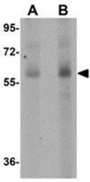 Anti-SR-BI antibody used in Western Blot (WB). GTX31791