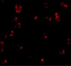 Anti-EFEMP1 antibody used in Immunocytochemistry/ Immunofluorescence (ICC/IF). GTX31792