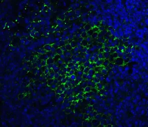 Anti-SQSTM1 / P62 antibody used in IHC (Paraffin sections) (IHC-P). GTX31795