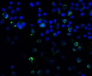 Anti-SQSTM1 / P62 antibody used in Immunocytochemistry/ Immunofluorescence (ICC/IF). GTX31795