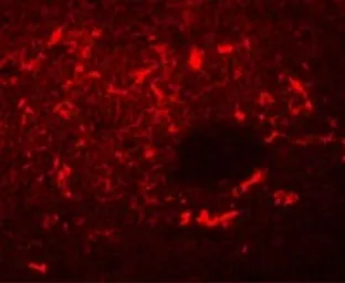 Anti-SQSTM1 / P62 antibody used in IHC (Paraffin sections) (IHC-P). GTX31795