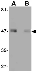 Anti-REEP4 antibody used in Western Blot (WB). GTX31796