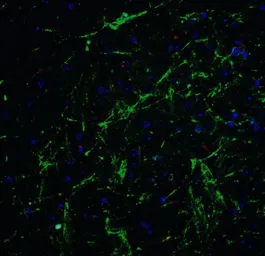 Anti-SOX2 antibody used in IHC (Paraffin sections) (IHC-P). GTX31797