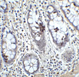 Anti-KLF4 antibody used in IHC (Paraffin sections) (IHC-P). GTX31798