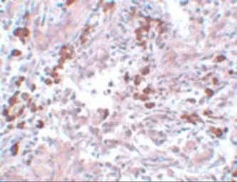 Anti-NABC1 antibody used in IHC (Paraffin sections) (IHC-P). GTX31800