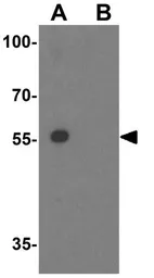 Anti-PIASy antibody used in Western Blot (WB). GTX31802