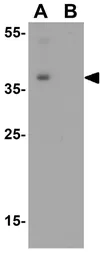 Anti-SAE1 antibody used in Western Blot (WB). GTX31803