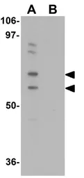 Anti-UBA2 antibody used in Western Blot (WB). GTX31804