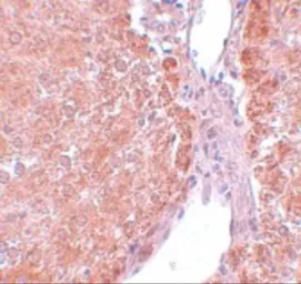 Anti-SUMO3 antibody used in IHC (Paraffin sections) (IHC-P). GTX31805
