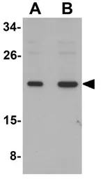 Anti-SUMO3 antibody used in Western Blot (WB). GTX31805