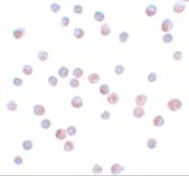 Anti-FOXO4 antibody used in Immunocytochemistry/ Immunofluorescence (ICC/IF). GTX31808