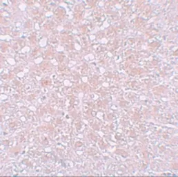 Anti-Alpha fetoprotein / AFP antibody used in IHC (Paraffin sections) (IHC-P). GTX31809