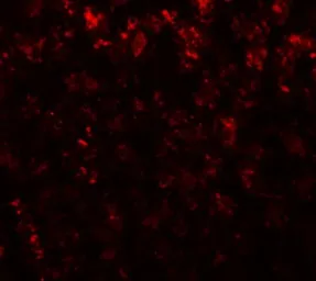 Anti-Alpha fetoprotein / AFP antibody used in IHC (Paraffin sections) (IHC-P). GTX31809