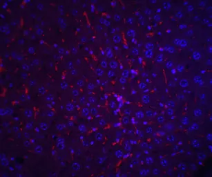 Anti-Alpha fetoprotein / AFP antibody used in IHC (Paraffin sections) (IHC-P). GTX31809