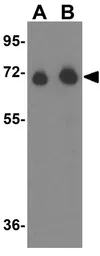 Anti-Alpha fetoprotein / AFP antibody used in Western Blot (WB). GTX31809