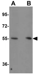 Anti-KPNA4 antibody used in Western Blot (WB). GTX31813