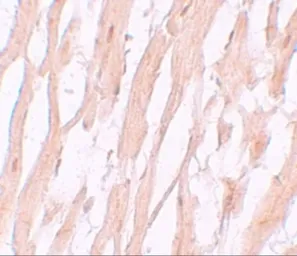 Anti-ATG9A antibody used in IHC (Paraffin sections) (IHC-P). GTX31815