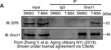 Anti-SLC39A9 antibody used in Western Blot (WB). GTX31817