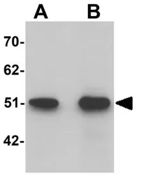 Anti-SLC39A9 antibody used in Western Blot (WB). GTX31817