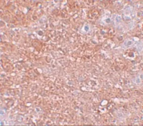Anti-SLC39A12 antibody used in IHC (Paraffin sections) (IHC-P). GTX31818