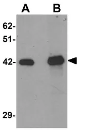 Anti-SLC39A12 antibody used in Western Blot (WB). GTX31818