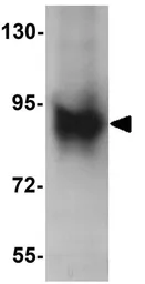Anti-Axin 2 antibody used in Western Blot (WB). GTX31822