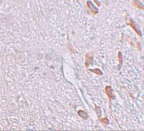 Anti-LRRTM1 antibody used in IHC (Paraffin sections) (IHC-P). GTX31823