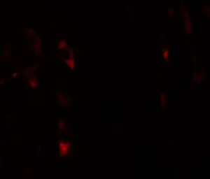 Anti-LRRTM1 antibody used in IHC (Paraffin sections) (IHC-P). GTX31823