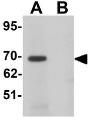 Anti-LRRTM1 antibody used in Western Blot (WB). GTX31823